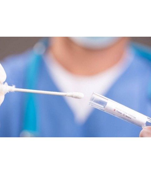TAMPONE COTONE NON STERILE AF X 100 PZ.