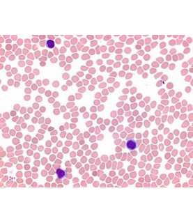 COLORANTE GIEMSA   500 ML.