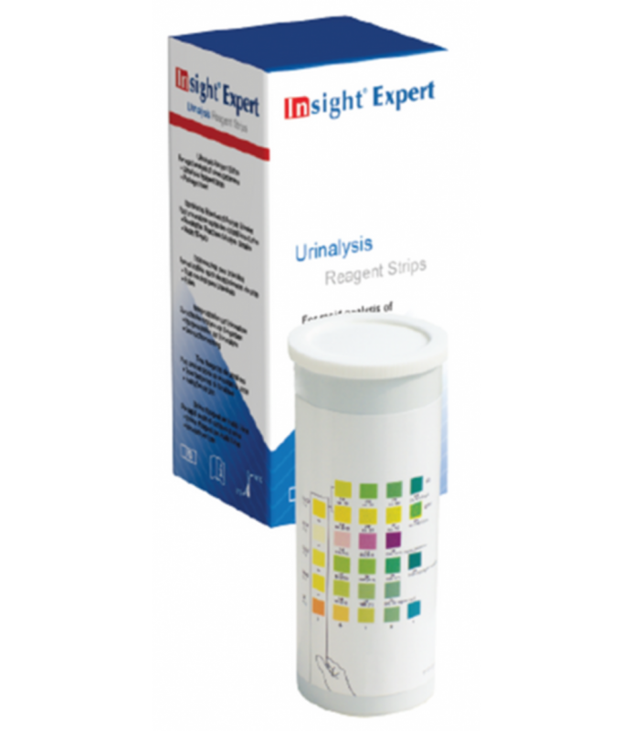 Test urine